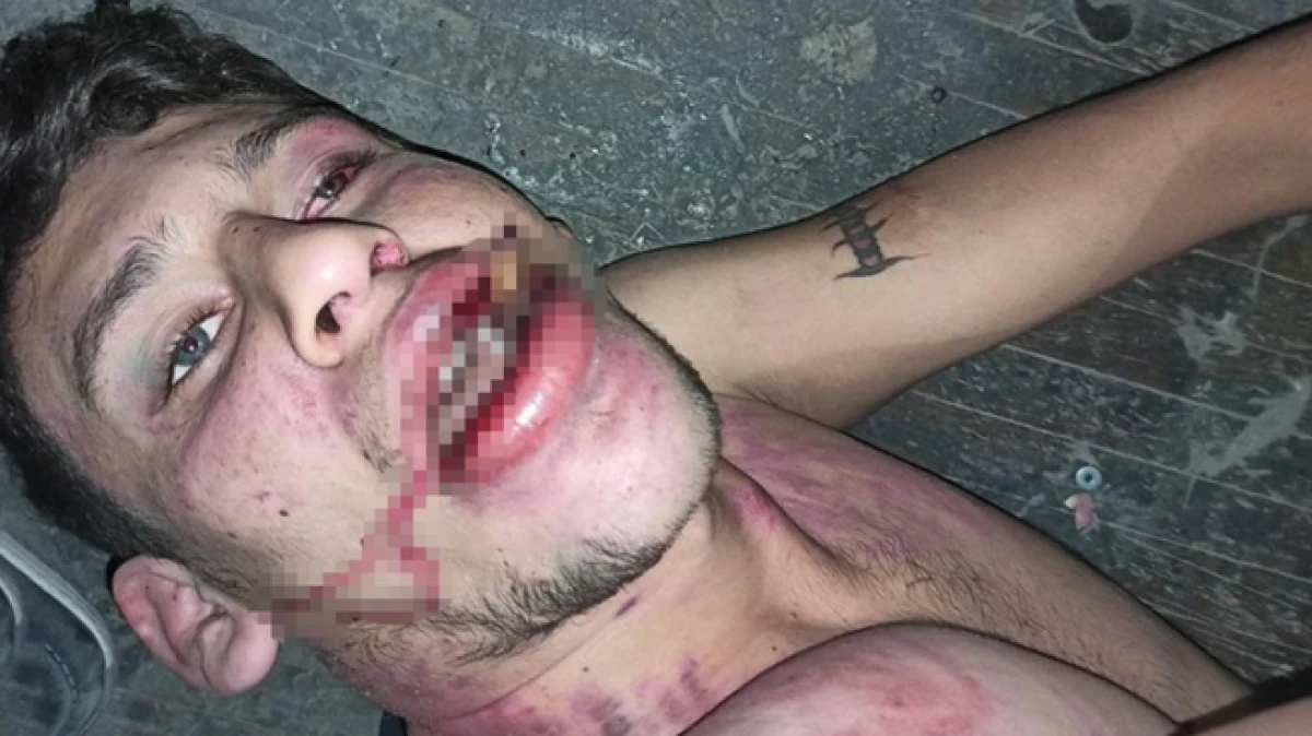  Antalya’da 23 yaşındaki gence hamam böceği yedirip işkence ettiler  Davada karar çıktı 